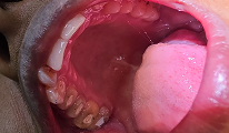 Dental treatment
