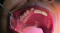 Dental treatment